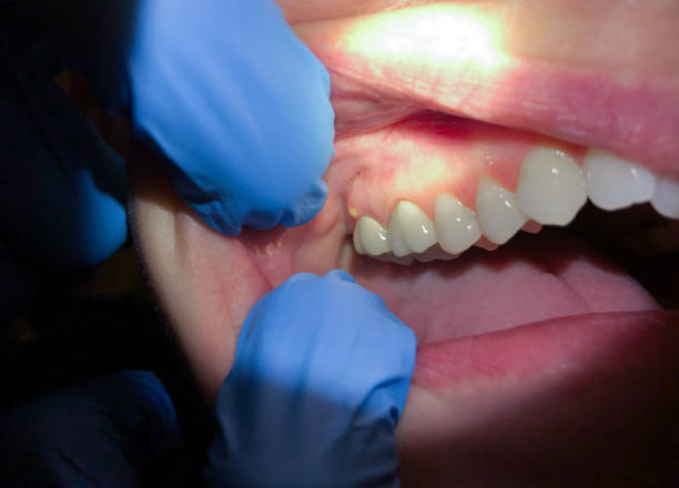 Best Walk-In Emergency Dental Services in Needville, TX